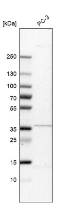 MGC16471 Antibody, Novus Biologicals 0.1mL; Unlabeled:Antibodies, Polyclonal